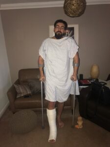 Max with his leg in a cast