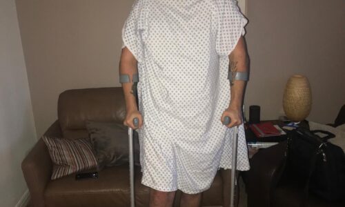 Max with his leg in a cast